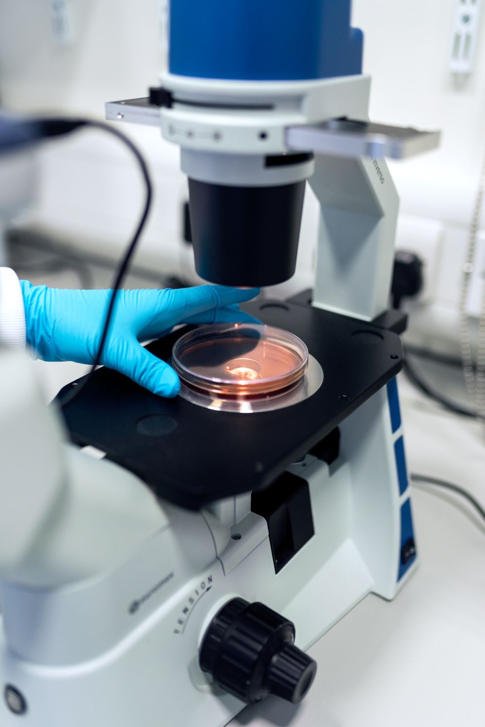 Gloved hand placing a petri dish under a laboratory microscope